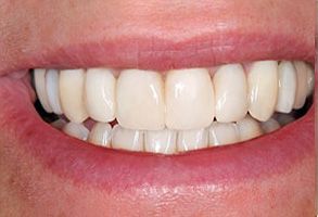 Astoria Dentistry | Teeth Whitening, Root Canals and CBCT