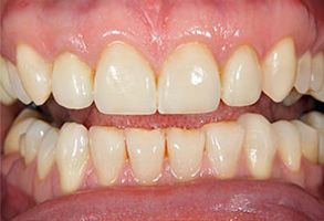 Astoria Dentistry | Dentures, Dental Cleanings and Teeth Whitening